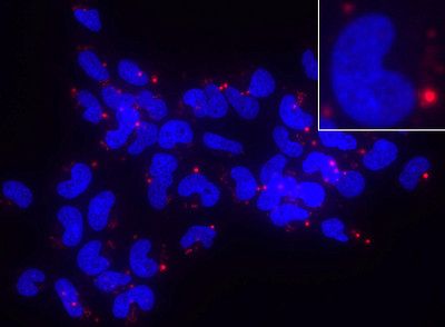 Zu sehen sind Neuroblastom-Zellen mit mindestens einen RNA-Ring (rot), der fast ausschließlich außerhalb des Zellkerns (blau) vorliegt.