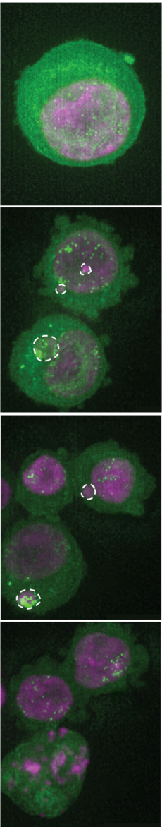 Bildfolge einer Zelle mit Mikrokernen während des Zelltods. Das Chromatin ist magenta/pink dargestellt, ringförmige DNA-Strukturen erscheinen grün. Die gestrichelten weißen Kreise markieren die Mikronuklei.