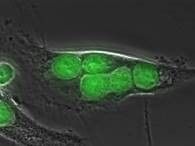 Phagozytose von Lymphomzellen in grün gezeigt