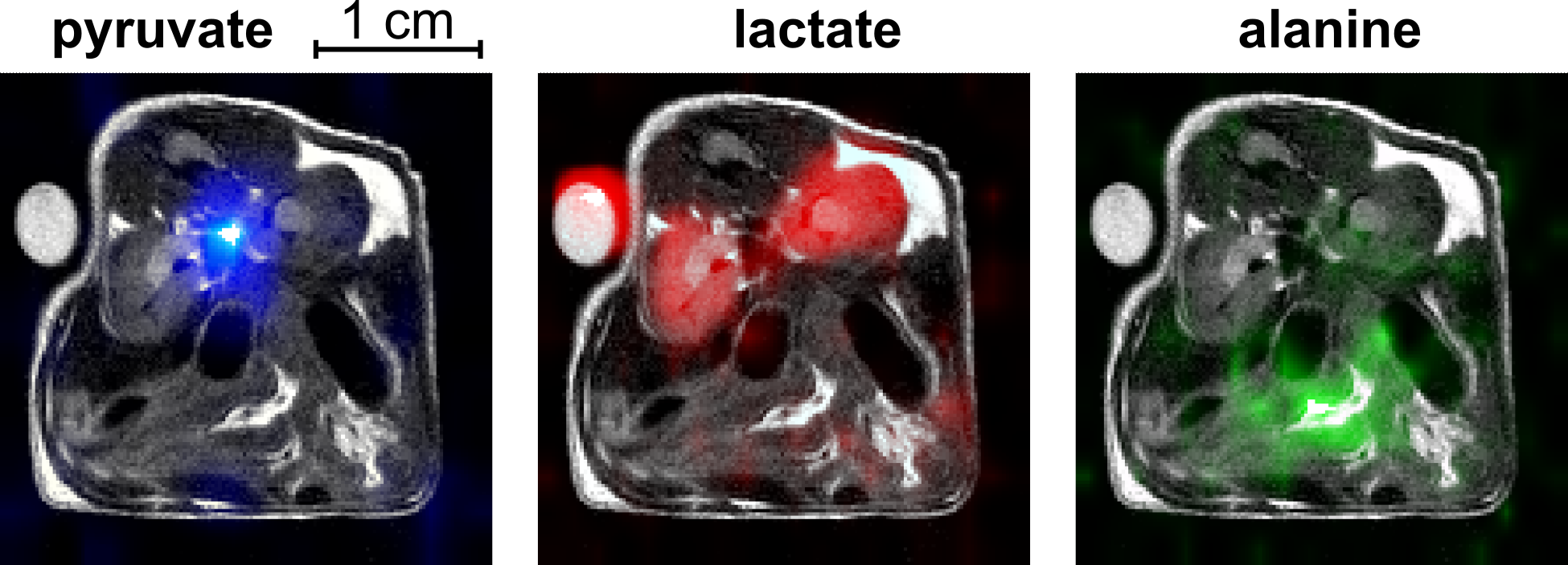 MRI image of a mouse: The hyperpolarized pyruvate (blue) is broken down into lactate and alanine. The time course, location and concentration of the process can be observed in the MRI.